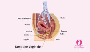 tampone vaginale