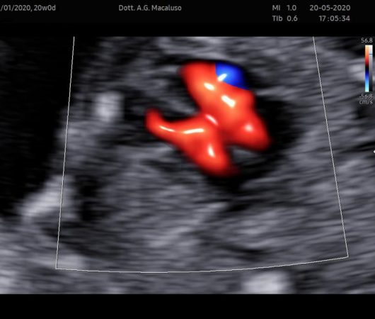 ecocardiografia fetale dr. macaluso